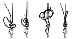 Фиксация узла УИАА